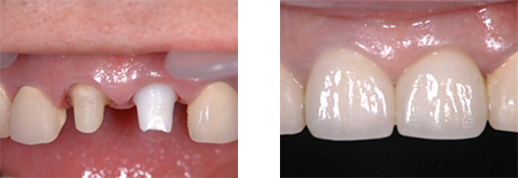 AFTER(術中・術後)