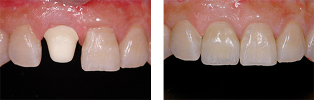 AFTER(術中・術後)