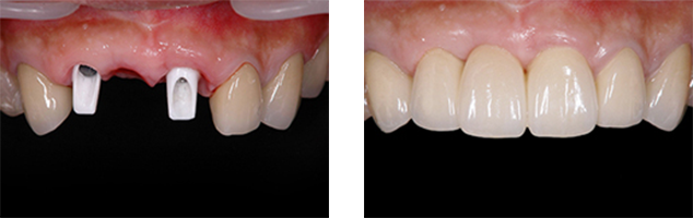 AFTER(術中・術後)