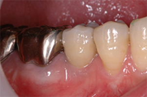 AFTER(術中・術後)