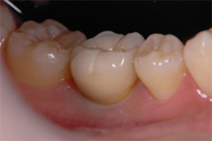 AFTER(術中・術後)