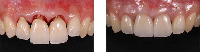 AFTER(術中・術後)