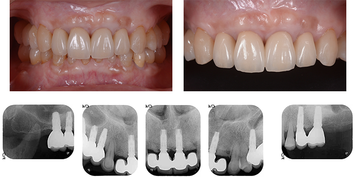 AFTER(術中・術後)