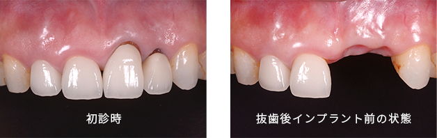 診査・診断・治療計画