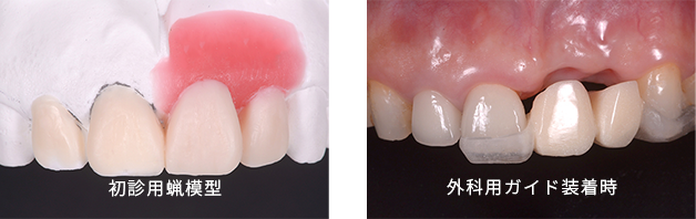 診査・診断・治療計画