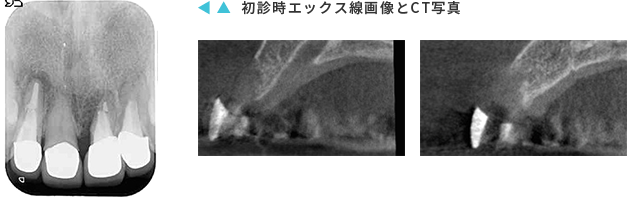 診査・診断・治療計画