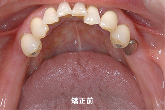 BEFORE(初診時)