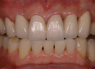 AFTER ( 術中・術後 )