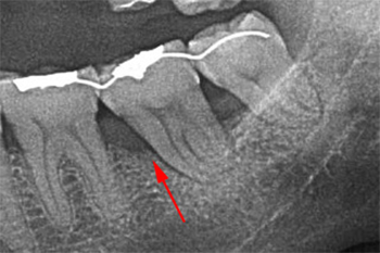 AFTER ( 術中・術後 )