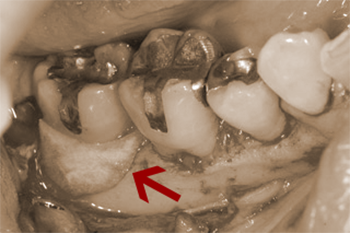 AFTER ( 術中・術後 )