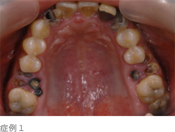 症例1