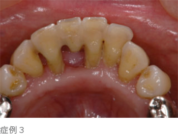 症例3