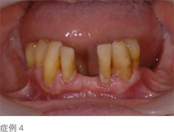 症例4