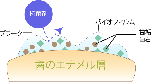 プラーク？歯石？バイオフィルム？