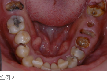 歯周病治療 健造デンタルクリニック
