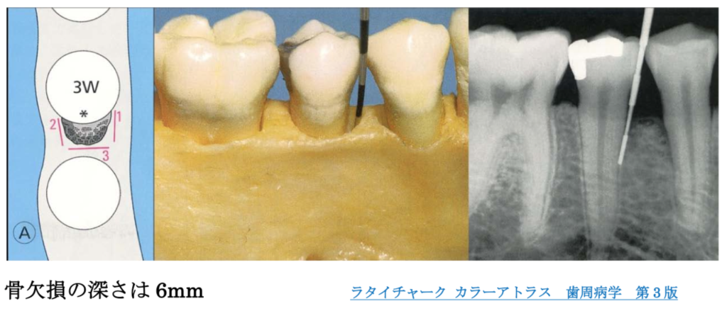 ラタイチャーク 歯周病学カラーアトラス www.toguuk.com