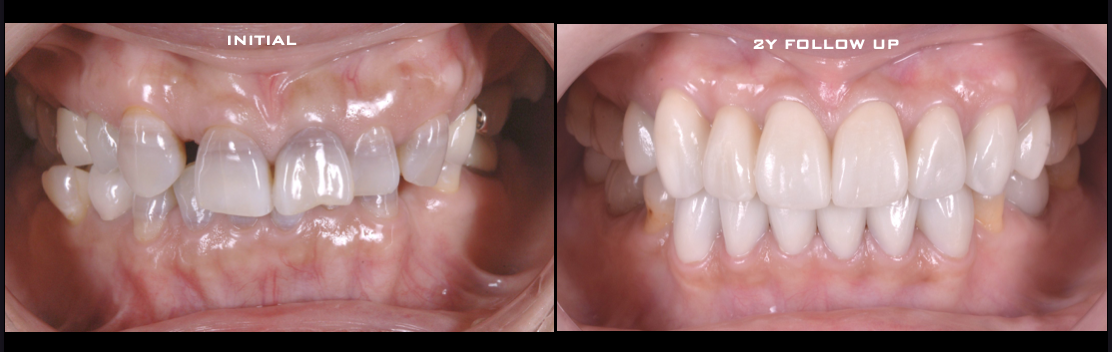 歯並びも変色した歯も気になる、どうしたら治りますか？
