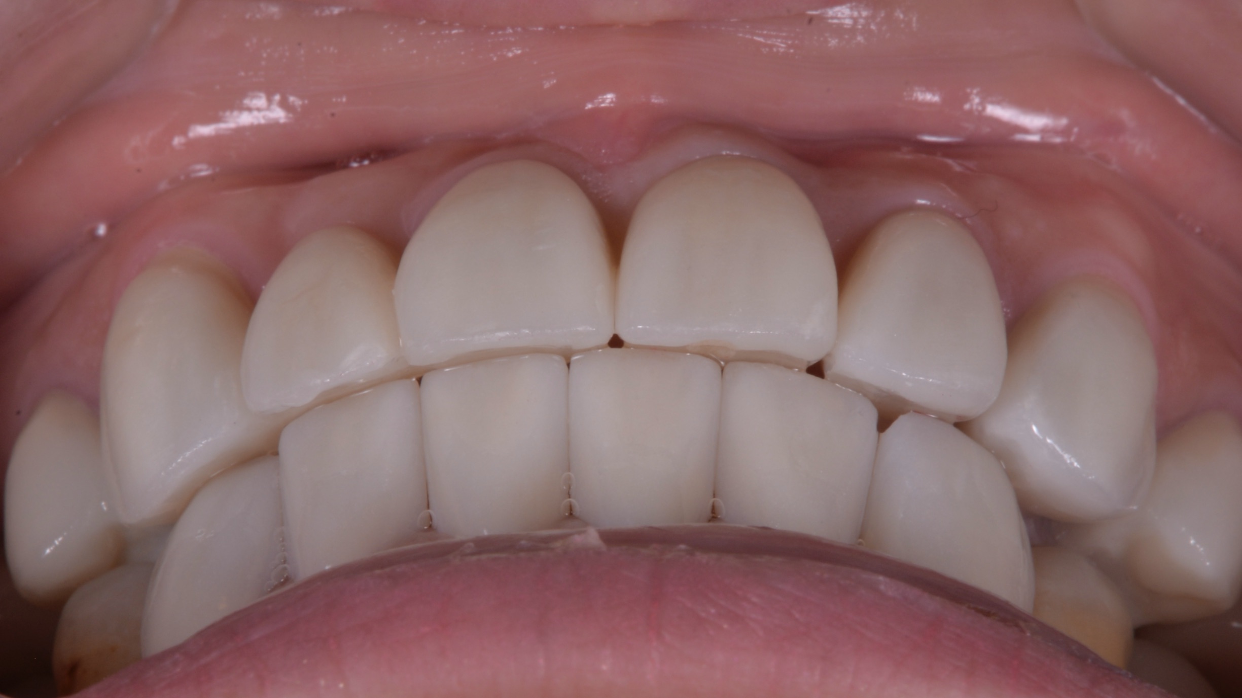 歯並びも変色した歯も気になる、どうしたら治りますか？