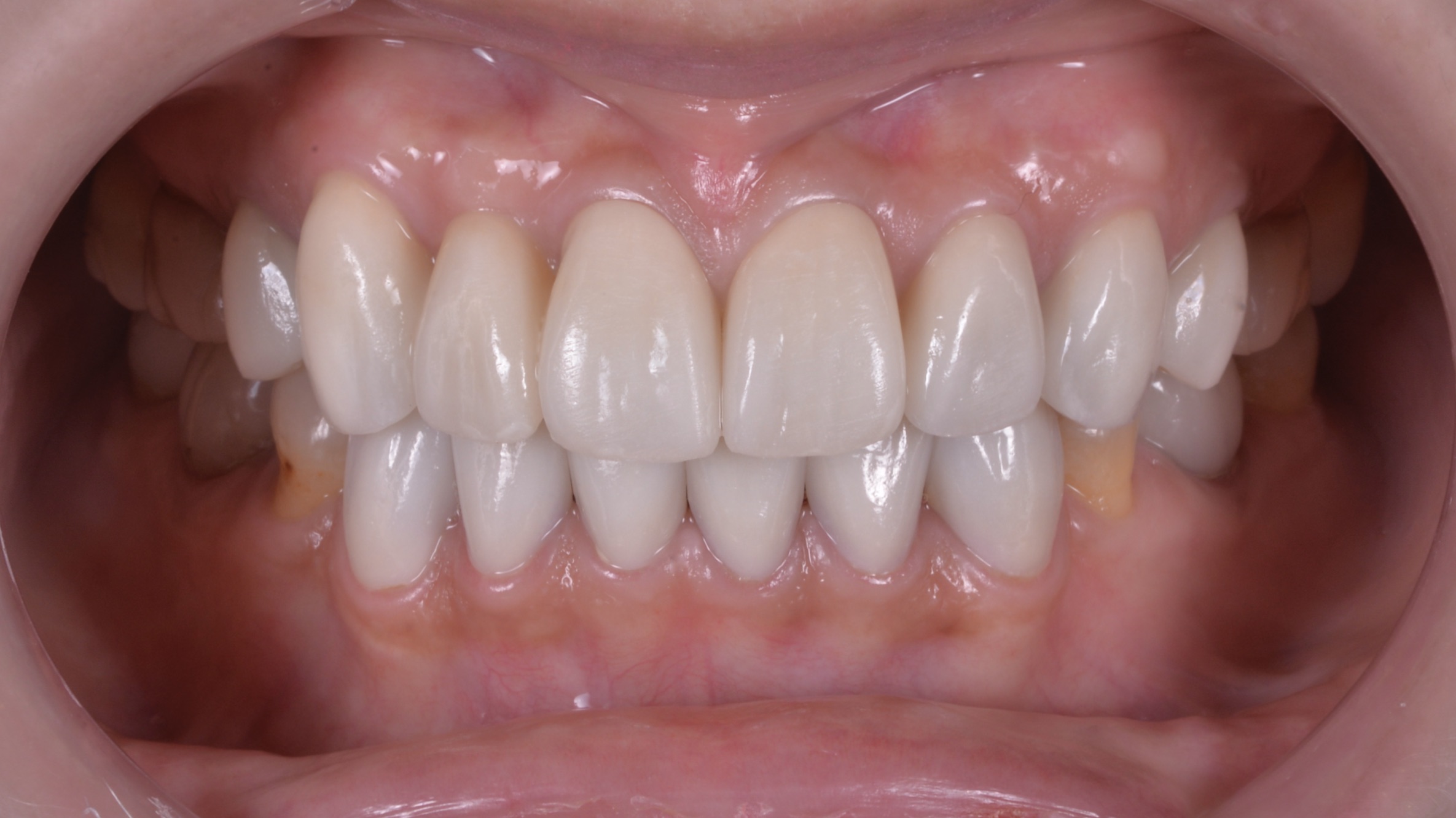 歯並びも変色した歯も気になる、どうしたら治りますか？