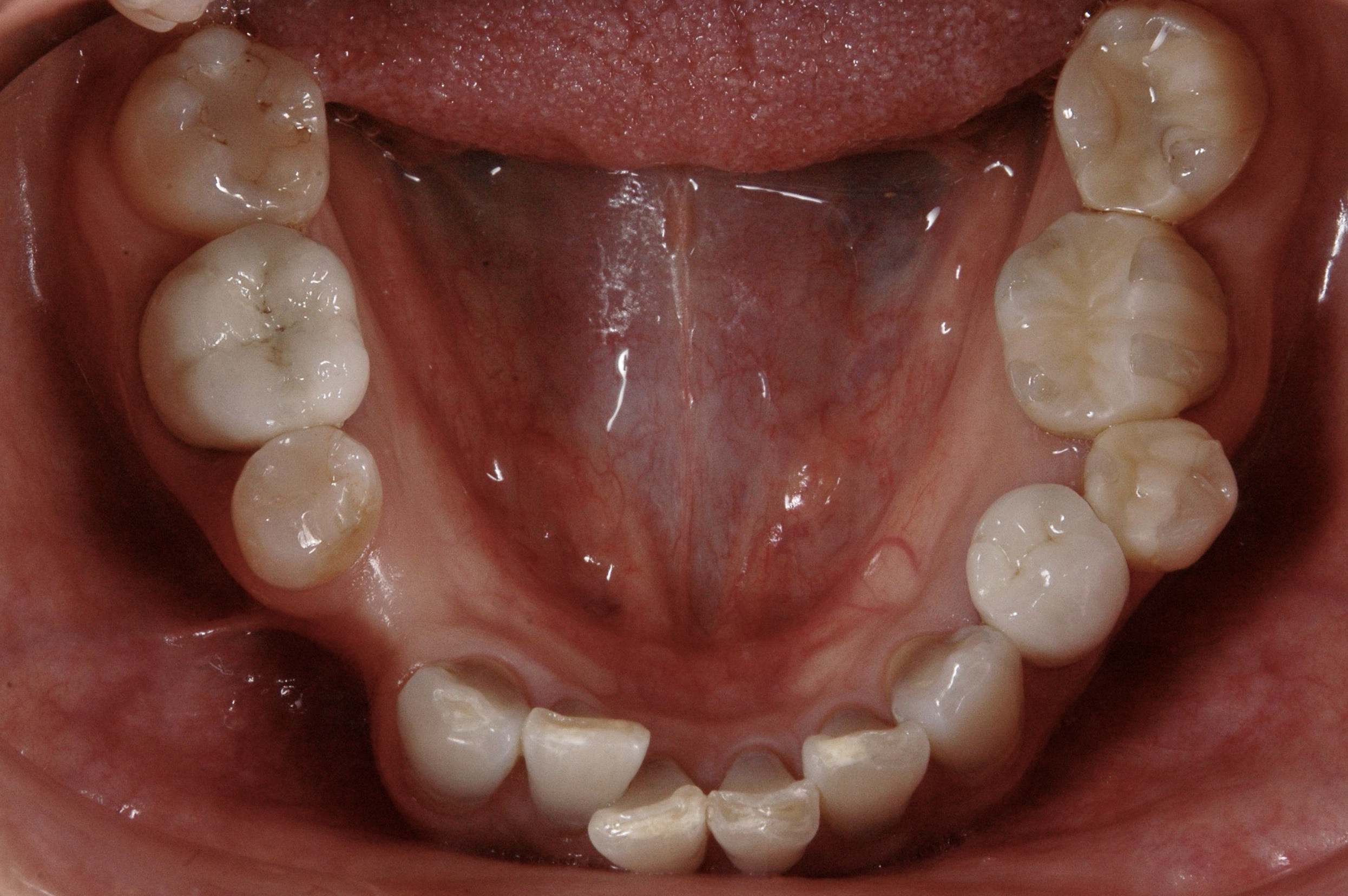 歯並びも変色した歯も気になる、どうしたら治りますか？
