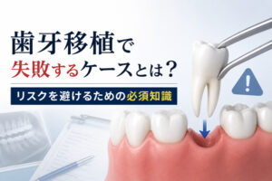 【専門医が解説】歯牙移植で失敗するケースとは?リスクを避けるための必須知識